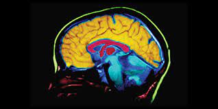 Introdución ao Envellecemento e as demencias neurodexenerativas
